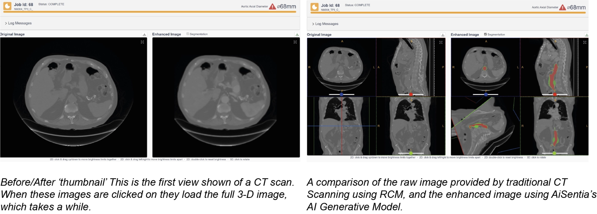 CT scan